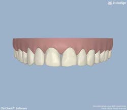 13decbfssegal04 13decbfssegal04