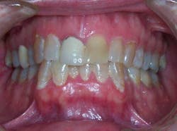 13decbfssegal05 13decbfssegal05