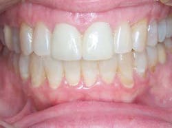 13decbfssegal06 13decbfssegal06