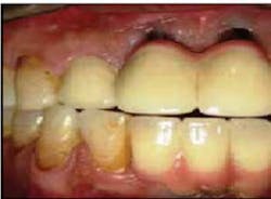 13deccrawfordparycbct01 13deccrawfordparycbct01