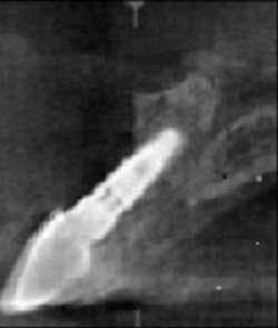 13deccrawfordparycbct02 13deccrawfordparycbct02