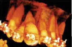 13deccrawfordparycbct03 13deccrawfordparycbct03