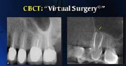13deccrawfordparycbct04 13deccrawfordparycbct04