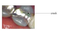 13decsimmonspwrofchoiceulmodwcrack 13decsimmonspwrofchoiceulmodwcrack