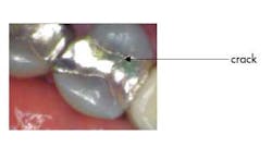 13decsimmonspwrofchoiceulmodwcrack 13decsimmonspwrofchoiceulmodwcrack