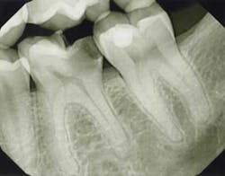 13nov19endolandwehrpreop 13nov19endolandwehrpreop