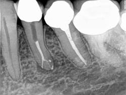 13octendovelezpostop 13octendovelezpostop