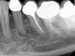 13octendovelezpreop 13octendovelezpreop