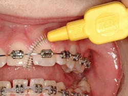 13octorthozellmeridbyellowortho 13octorthozellmeridbyellowortho