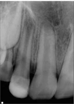 1405endopetrinoregenendo01 1405endopetrinoregenendo01
