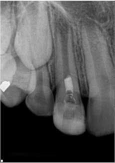 1405endopetrinoregenendo02 1405endopetrinoregenendo02