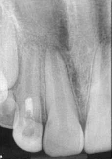 1405endopetrinoregenendo03 1405endopetrinoregenendo03