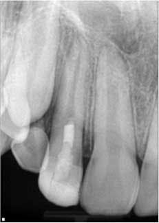 1405endopetrinoregenendo04 1405endopetrinoregenendo04