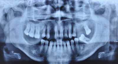 14apr10srrgardonmollardharmony01