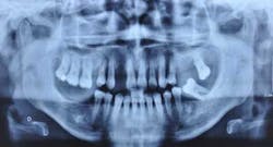 14apr10srrgardonmollardharmony01 14apr10srrgardonmollardharmony01