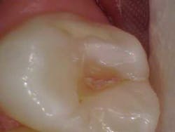 14apr15endosimmonsquicktips03 14apr15endosimmonsquicktips03