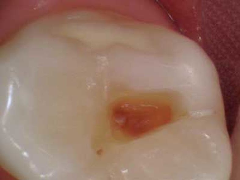 14apr15endosimmonsquicktips04