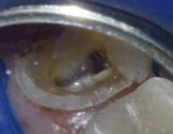 14apr15endosimmonsquicktips05 14apr15endosimmonsquicktips05