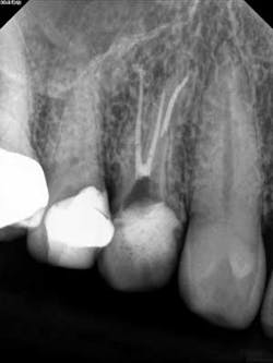 14apr15endosimmonsquicktips06 14apr15endosimmonsquicktips06