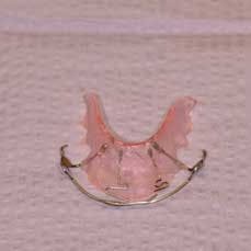 14apr17bfsperronehawley03 14apr17bfsperronehawley03