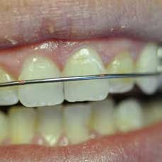 14apr17bfsperronehawley10 14apr17bfsperronehawley10