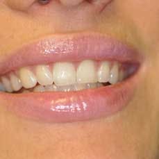 14apr17bfsperronehawley11 14apr17bfsperronehawley11