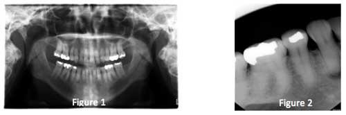 14aug19endoborgia01 02