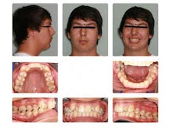 14aug21bfssimmons01 14aug21bfssimmons01