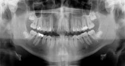 14aug21bfssimmons02 14aug21bfssimmons02