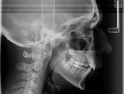 14aug21bfssimmons03 14aug21bfssimmons03