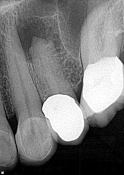 14dec16endosimmons01 14dec16endosimmons01