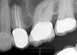 14dec16endosimmons02 14dec16endosimmons02