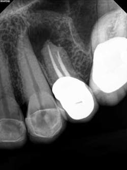 14dec16endosimmons03 14dec16endosimmons03