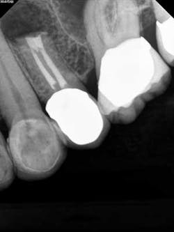 14dec16endosimmons04 14dec16endosimmons04