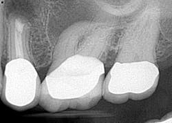 14dec16endosimmons05 14dec16endosimmons05