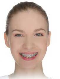 14dec18bfsgiesey01 14dec18bfsgiesey01