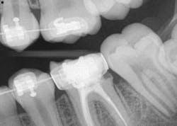 14dec18bfssimmons01 14dec18bfssimmons01