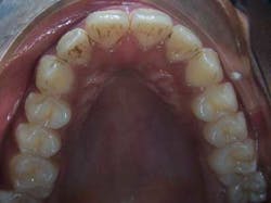 14janbfssegaltreatface01 14janbfssegaltreatface01