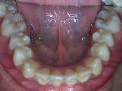 14janbfssegaltreatface02 14janbfssegaltreatface02