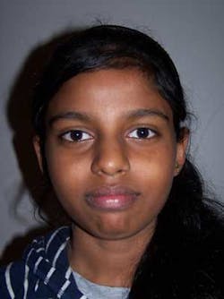 14janbfssegaltreatface03 14janbfssegaltreatface03