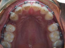 14janbfssegaltreatface05 14janbfssegaltreatface05