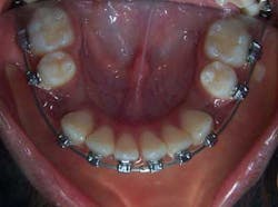 14janbfssegaltreatface06 14janbfssegaltreatface06