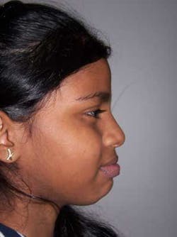 14janbfssegaltreatface07 14janbfssegaltreatface07