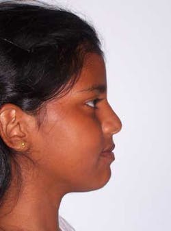 14janbfssegaltreatface08 14janbfssegaltreatface08