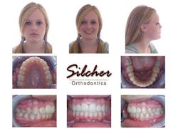 14janbfssilcherafter 14janbfssilcherafter