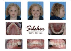 14janbfssilcherbefore 14janbfssilcherbefore