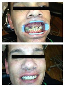 14jansadrimethcase 14jansadrimethcase