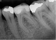 14jul15endobelaniradix01 14jul15endobelaniradix01