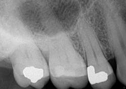 14jul15endosimmonscantsave01 14jul15endosimmonscantsave01