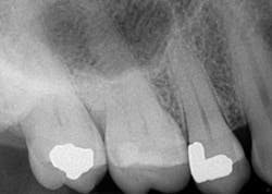 14jul15endosimmonscantsave01 14jul15endosimmonscantsave01